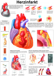 Anatomie Poster «Herzinfarkt» 50 x 70 cm, laminiert 