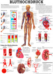Anatomie-Poster «Bluthochdruck» 50 x 70 cm, laminiert 