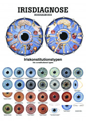 Lehrtafel «Irisdiagnose» laminert 