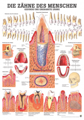 Lehrtafel «Gesunde Zähne und Zahnkrankheiten» laminiert 