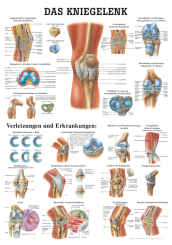 Anatomieposter «Das menschliche Kniegelenk» 70 x 100 cm, laminiert 