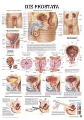 Medizinische Lehrtafel «Die Prostata» laminiert 